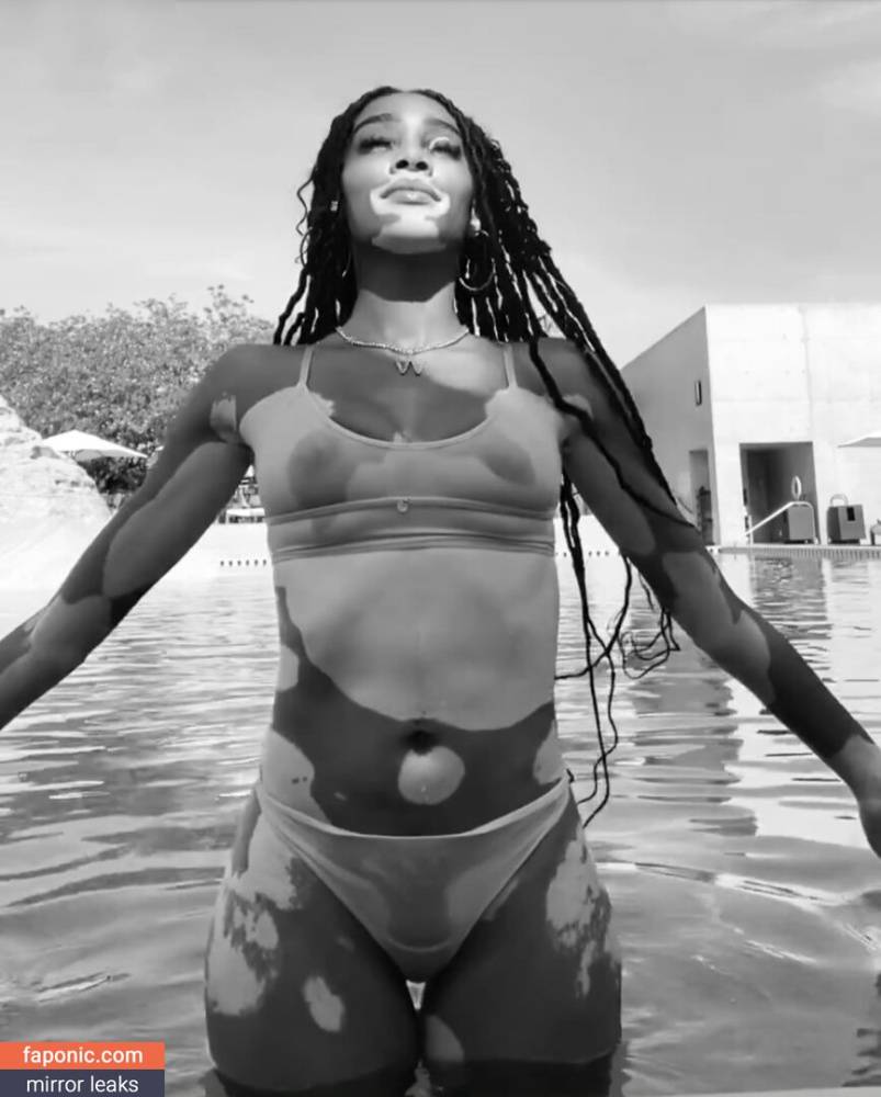 Winnie Harlow aka winnieharlow Nude Leaks - #1