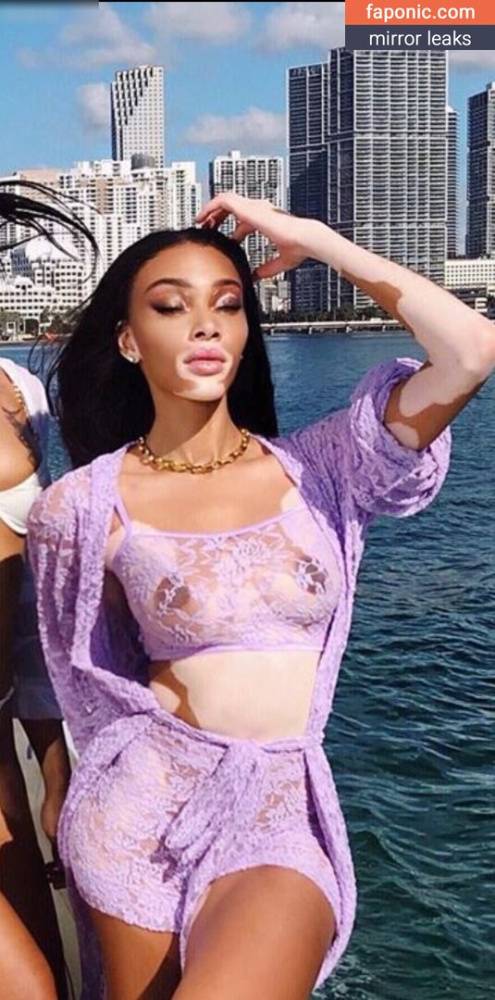 Winnie Harlow aka winnieharlow Nude Leaks - #18