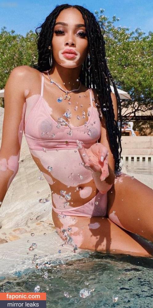 Winnie Harlow aka winnieharlow Nude Leaks - #4