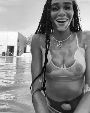 Winnie Harlow / winnieharlow Nude Leaks - Fapello - #21