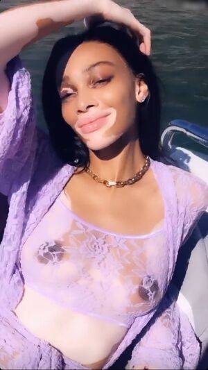 Winnie Harlow / winnieharlow Nude Leaks - Fapello - #27