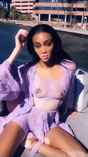 Winnie Harlow / winnieharlow Nude Leaks - Fapello - #25