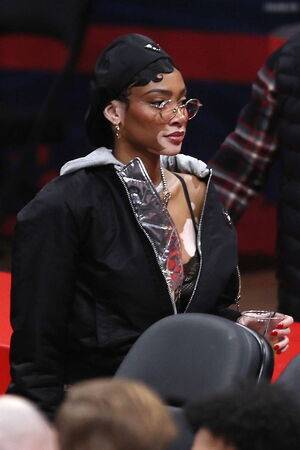 Winnie Harlow / winnieharlow Nude Leaks - Fapello - #6