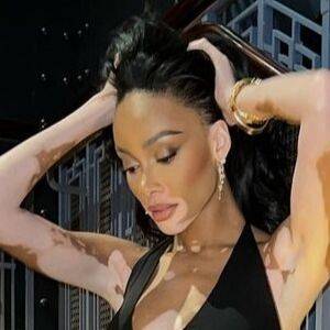 Winnie Harlow / winnieharlow Nude Leaks - Fapello - #1