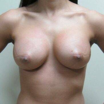 Brittney Atwood Nude Boob Job Pictures Leaked on modeladdicts.com